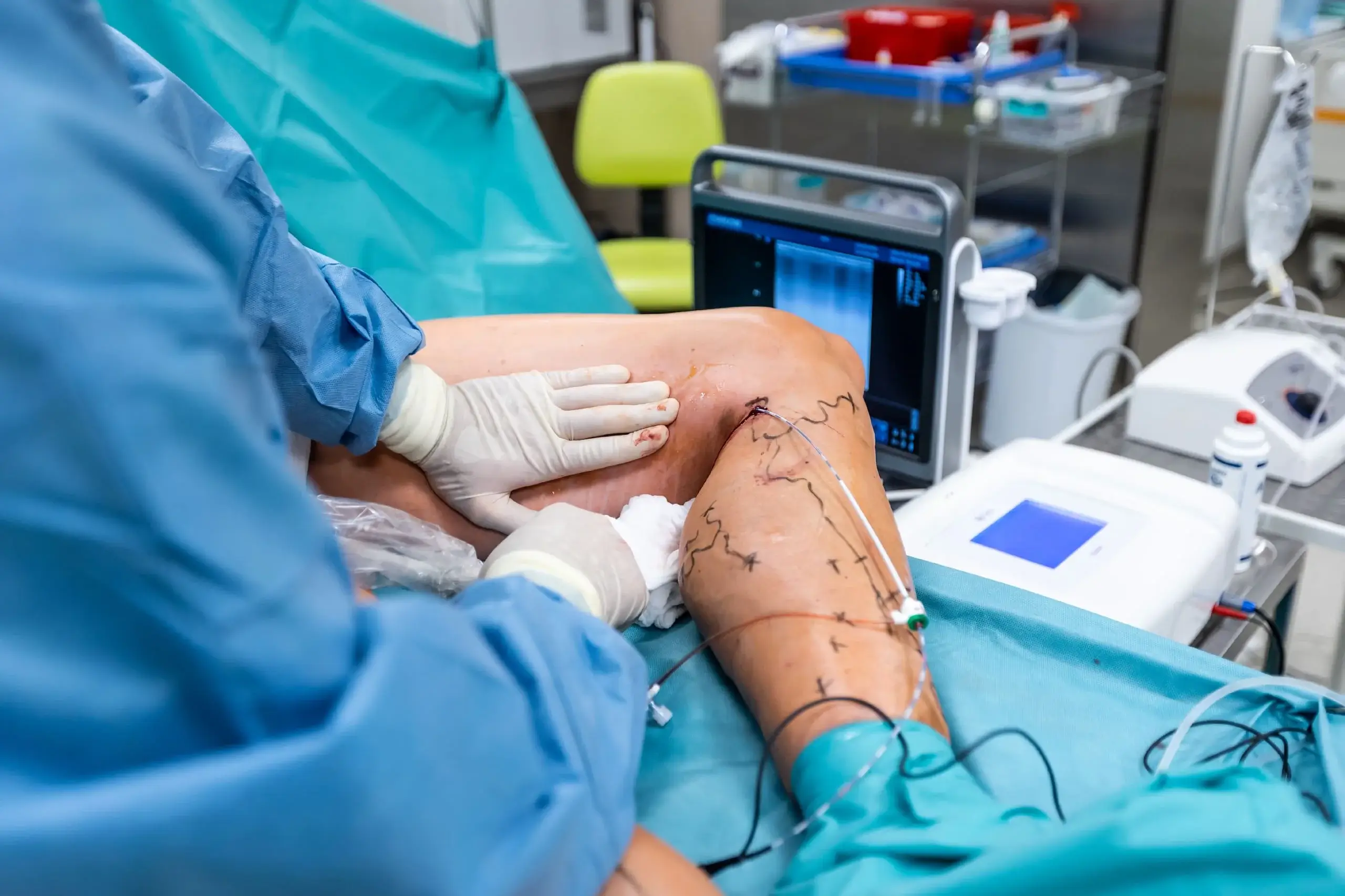 vascular-surgery